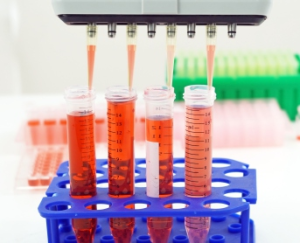 What’s the advantage while customer use AELAB adjustable tip spacing pipette?