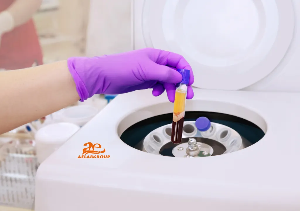 Key Features in Selecting a Vortex Mixer and Centrifuge AELAB