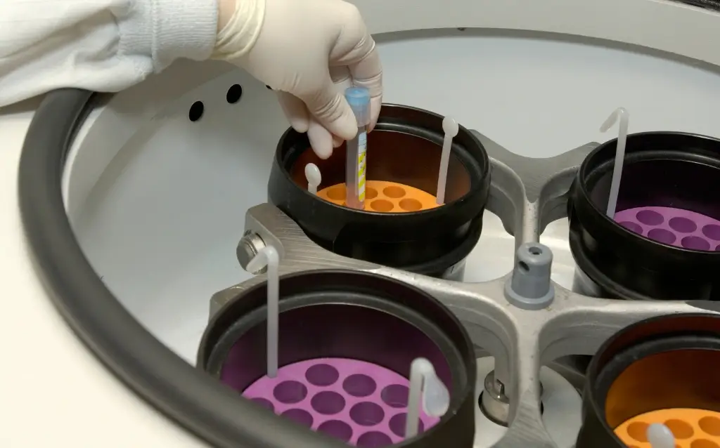 Benchtop High-Speed Refrigerated Centrifuge Maintenance Tips AELAB