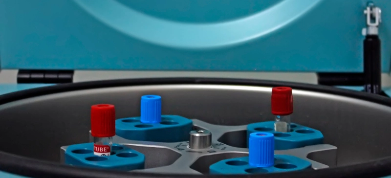 Understanding Centrifugal Force and Centrifuge Machines: Applications, Benefits, and Key Differences