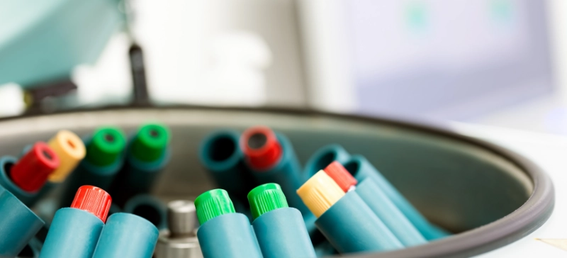 Centrifuge Safety Practices for Risk Prevention AELAB