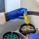 Understanding Centrifugal Force and Centrifuge Machines: Applications, Benefits, and Key Differences