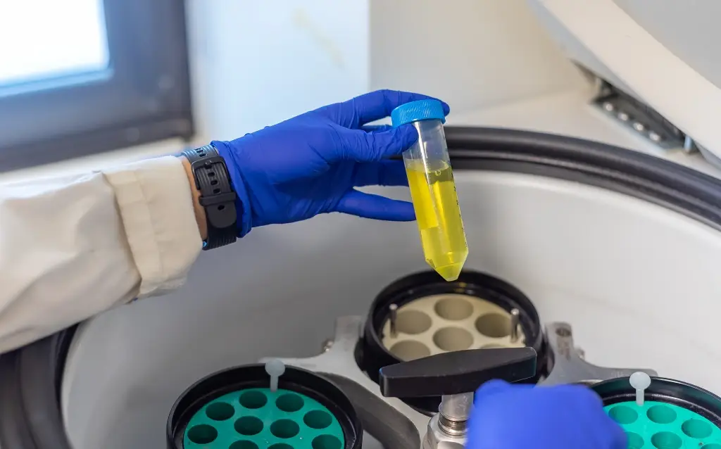 Understanding Centrifugal Force and Centrifuge Machines: Applications, Benefits, and Key Differences AELAB