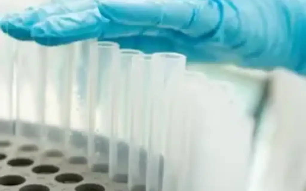 Fraction Collectors: Key Features, Applications, Uses, and FAQs AELAB