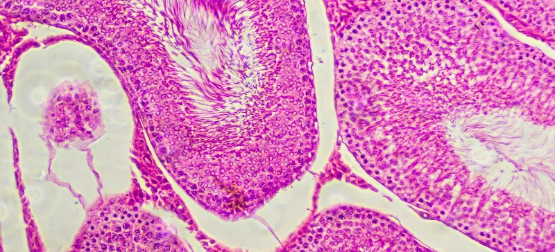 Tissue Processor in Histology Automatic & Manual Processing Steps AELAB